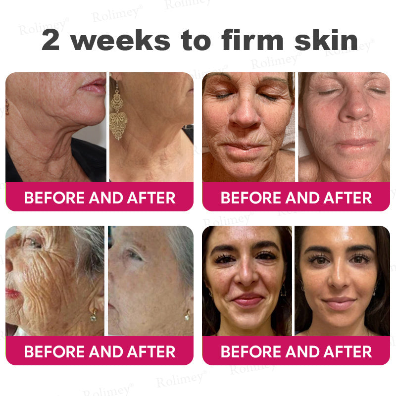 👨‍⚕️Made and shipped from USA 💫Rolimey® Botox & Retinol Shot Wrinkle Reducing Multi Balm - Last Day Promotion 70% OFF