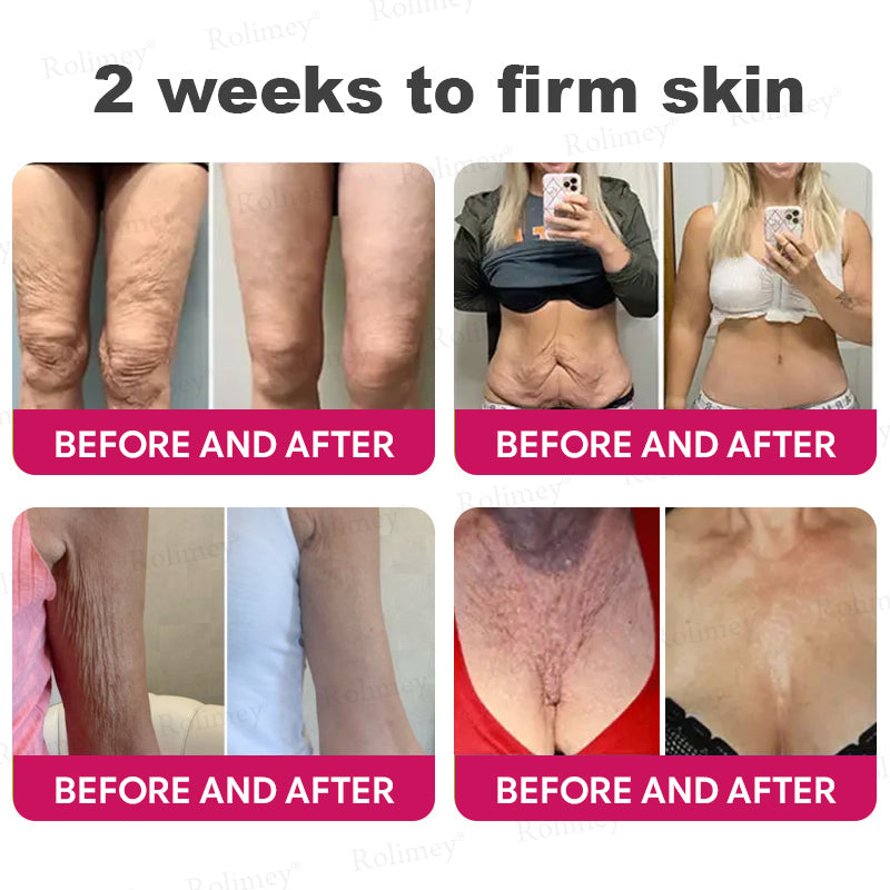 👨‍⚕️Made and shipped from USA 💫Rolimey® Botox & Retinol Shot Wrinkle Reducing Multi Balm - Last Day Promotion 70% OFF