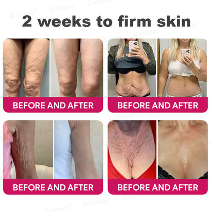 👨‍⚕️Made and shipped from USA 💫Rolimey® Botox & Retinol Shot Wrinkle Reducing Multi Balm - Last Day Promotion 70% OFF