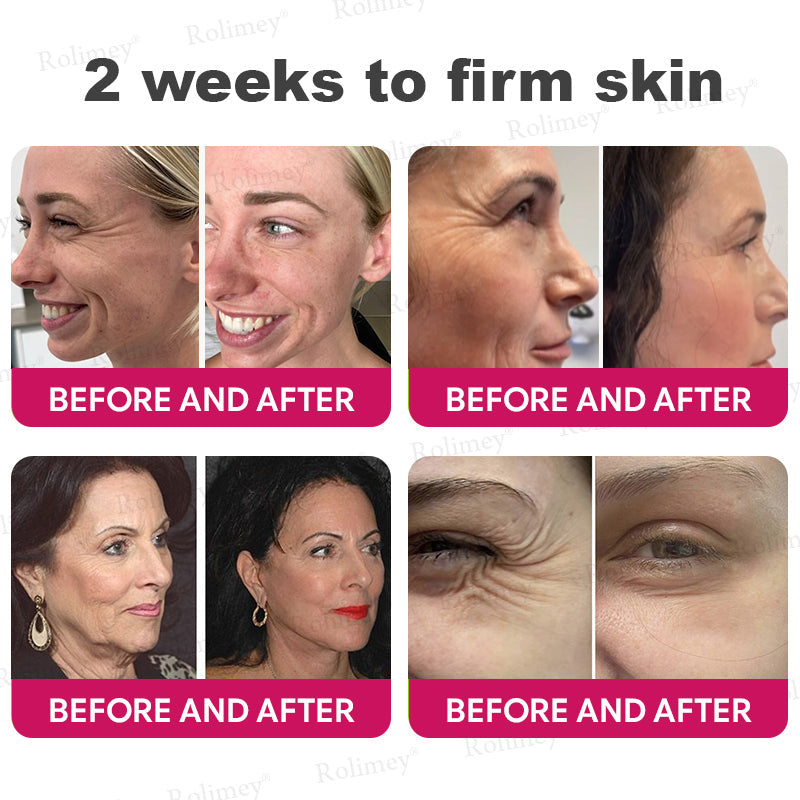 👨‍⚕️Made and shipped from USA 💫Rolimey® Botox & Retinol Shot Wrinkle Reducing Multi Balm - Last Day Promotion 70% OFF