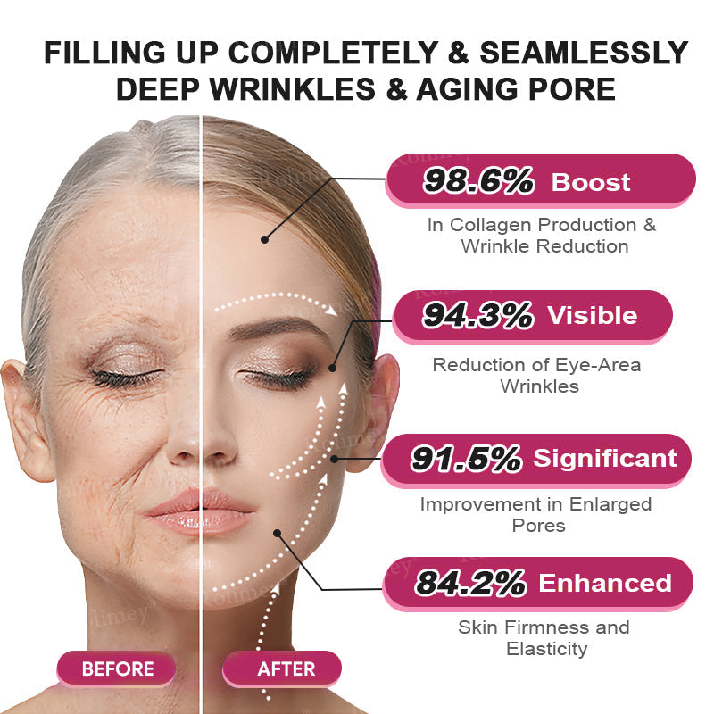 👨‍⚕️Made and shipped from USA 💫Rolimey® Botox & Retinol Shot Wrinkle Reducing Multi Balm - Last Day Promotion 70% OFF