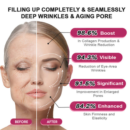 👨‍⚕️Made and shipped from USA 💫Rolimey® Botox & Retinol Shot Wrinkle Reducing Multi Balm - Last Day Promotion 70% OFF